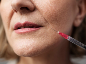 Enhance Your Beauty with Filler Treatments in Colorado Springs