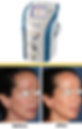 M22 before and after image.png