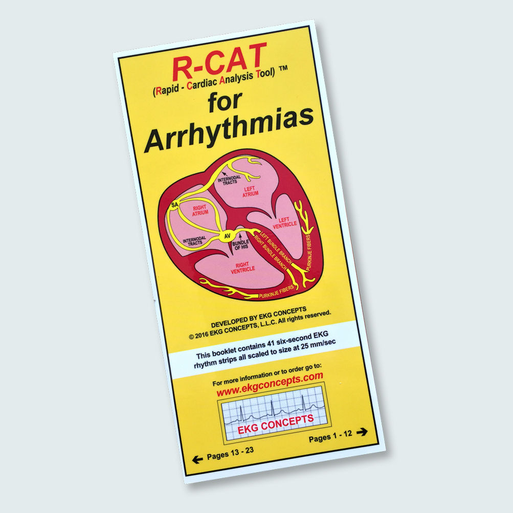 R-CAT for Arrhythmias