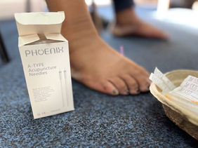 Community Acupuncture Clinic in GP practice - reflections from the ground By Josephine Cerqua