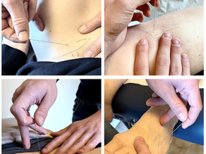 Location, Location, Location: Advancing your Point Location and Needling Skills - Saturday 9th May 2026
