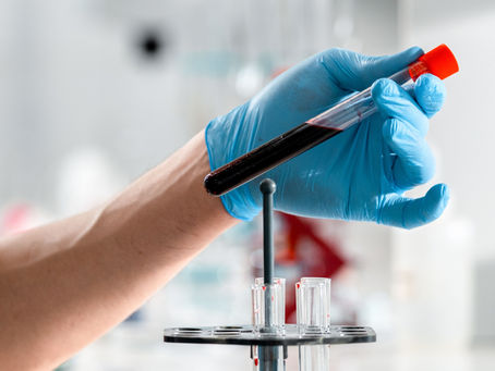 Could a Blood Test Help Predict TTTS Earlier?