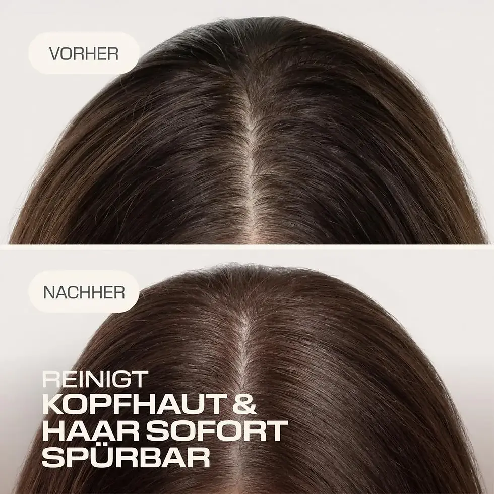 Miniaturbild: GOLDWELL Dualsenses Scalp Spezialist Tiefenreinigendes Shampoo 250 ml