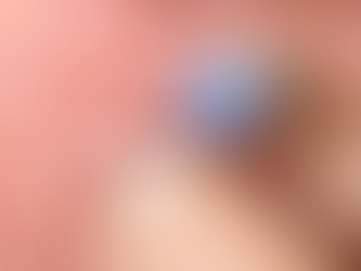 Projeto de lei propõe fornecimento gratuito de sensores para controle de diabetes tipo 1