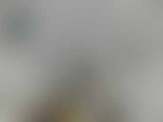 Hemominas consolida produção de colírio feito a partir do sangue do próprio paciente