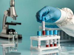 Laboratórios clandestinos e redes sociais eram usados para distribuir anabolizantes falsificados