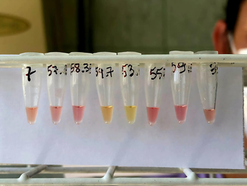 Pesquisadora da UFSM cria teste rápido que detecta tuberculose em apenas uma hora