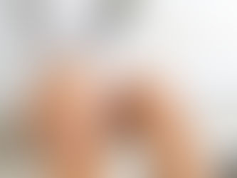 你是退化性關節炎的高風險族群嗎?