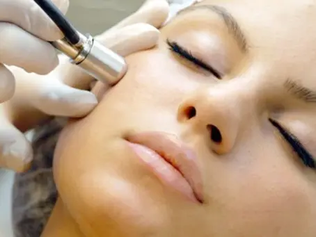 Revealing Radiance: The Marvels of Microdermabrasion