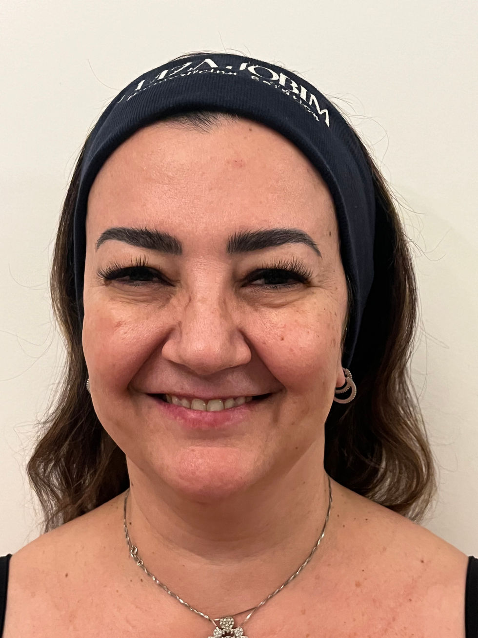 Toxina botulínica (botox) e bioestimulador de colágeno