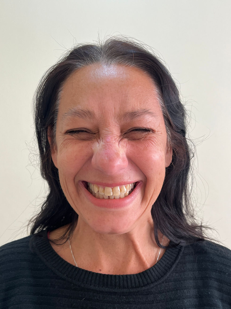 Toxina botulínica (botox)
