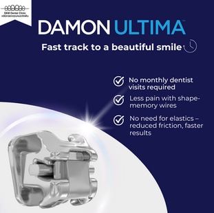 “A Beautiful Smile Without Waiting Years with Damon Ultima System” ⏳🦷