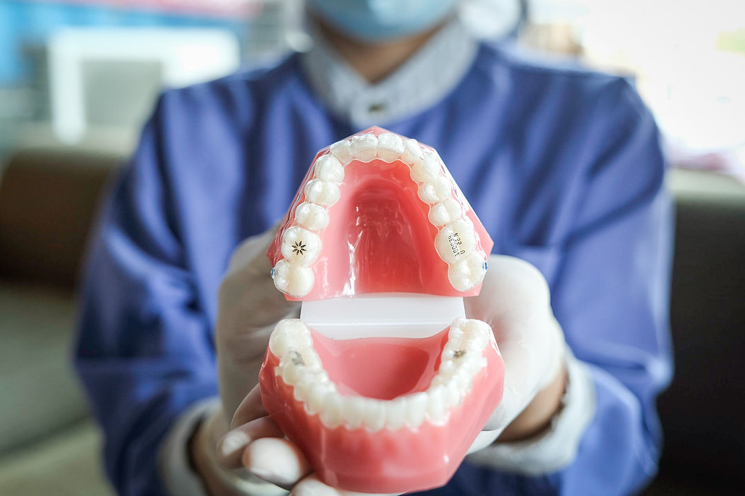 ผู้ช่วยทันตแพทย์จากคลินิกสองคุณหมอจัดฟันขอนแก่น (SKM Dental Clinic) กำลังสาธิตการติดตั้งเครื่องมือจัดฟันใส Invisalign บนโมเดลฟันจำลอง