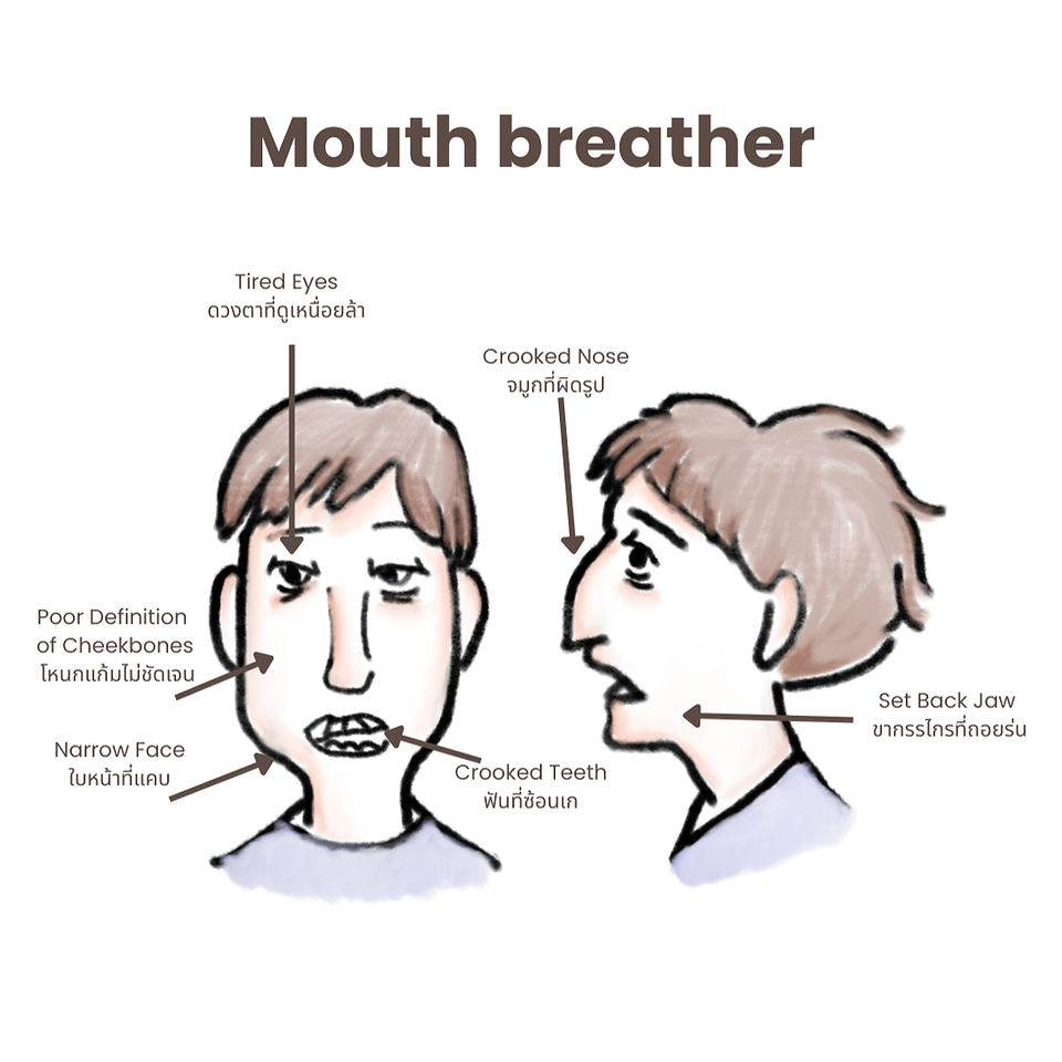 Orthodontic Treatment in Khon kaen