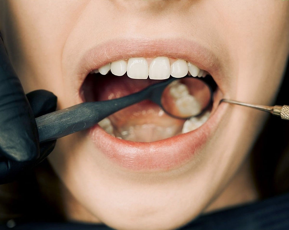 Prim-plan cu gura deschisă la dentist, oglindă și instrumente examinând dinții; atmosferă clinică, alb și negru.