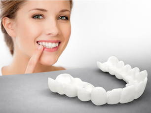 Ai pus fațete dentare universale din farmacie? Citește asta