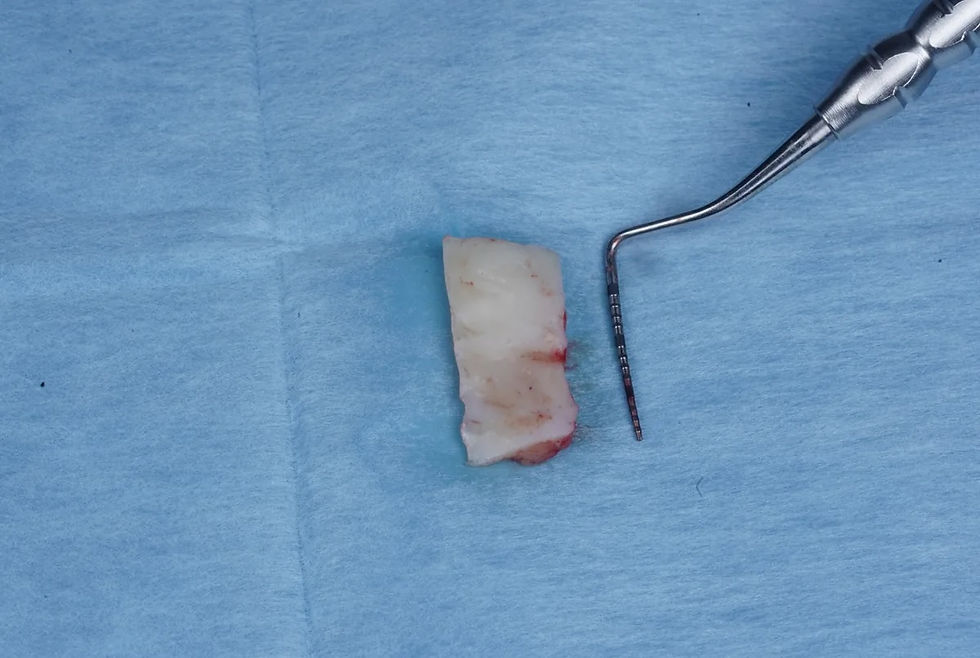 Țesut albicios pe câmp albastru, lângă un instrument metalic chirurgical; imagine clinică, sterilă.