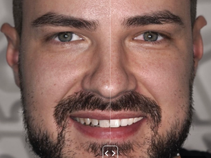 Test drive pentru zâmbet? Acum e posibil.