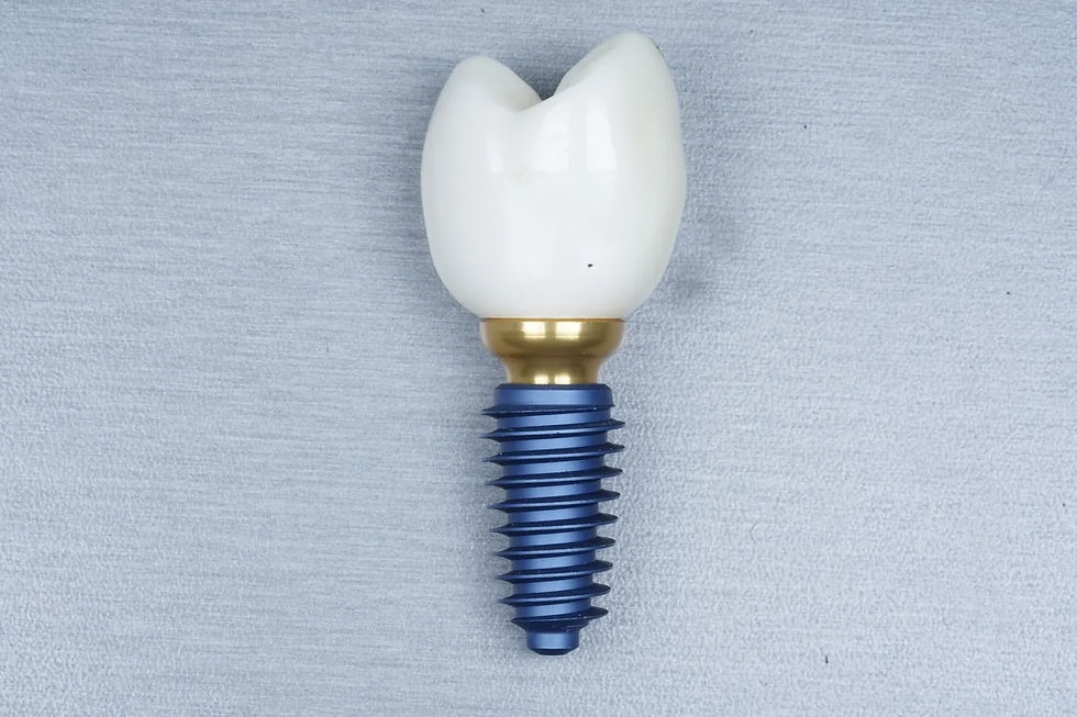 Implant dentar cu coroană albă și șurub albastru, pe fundal gri, fotografiat de aproape.