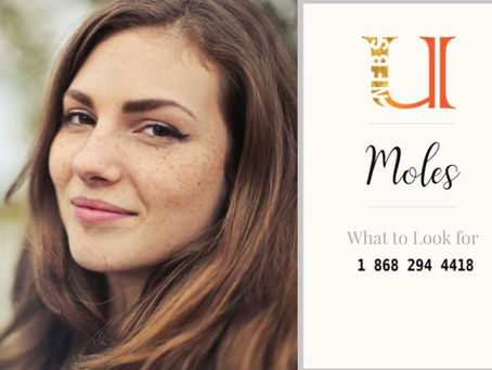 Moles – What to Look For
