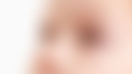 Conjunctivitis: (Pink eye) Bacterial, Viral, Allergic & Other Types