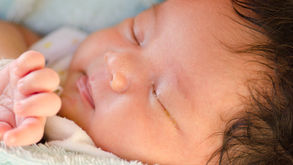 Blocked Tear (nasolacrimal) Ducts in Infants