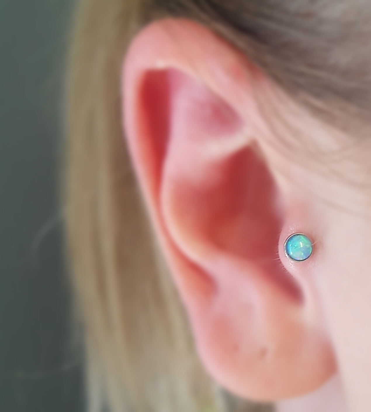 Healed tragus piercing
