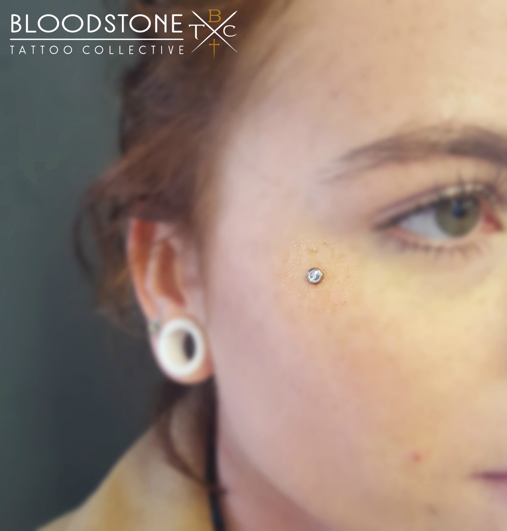 Teardrop Dermal