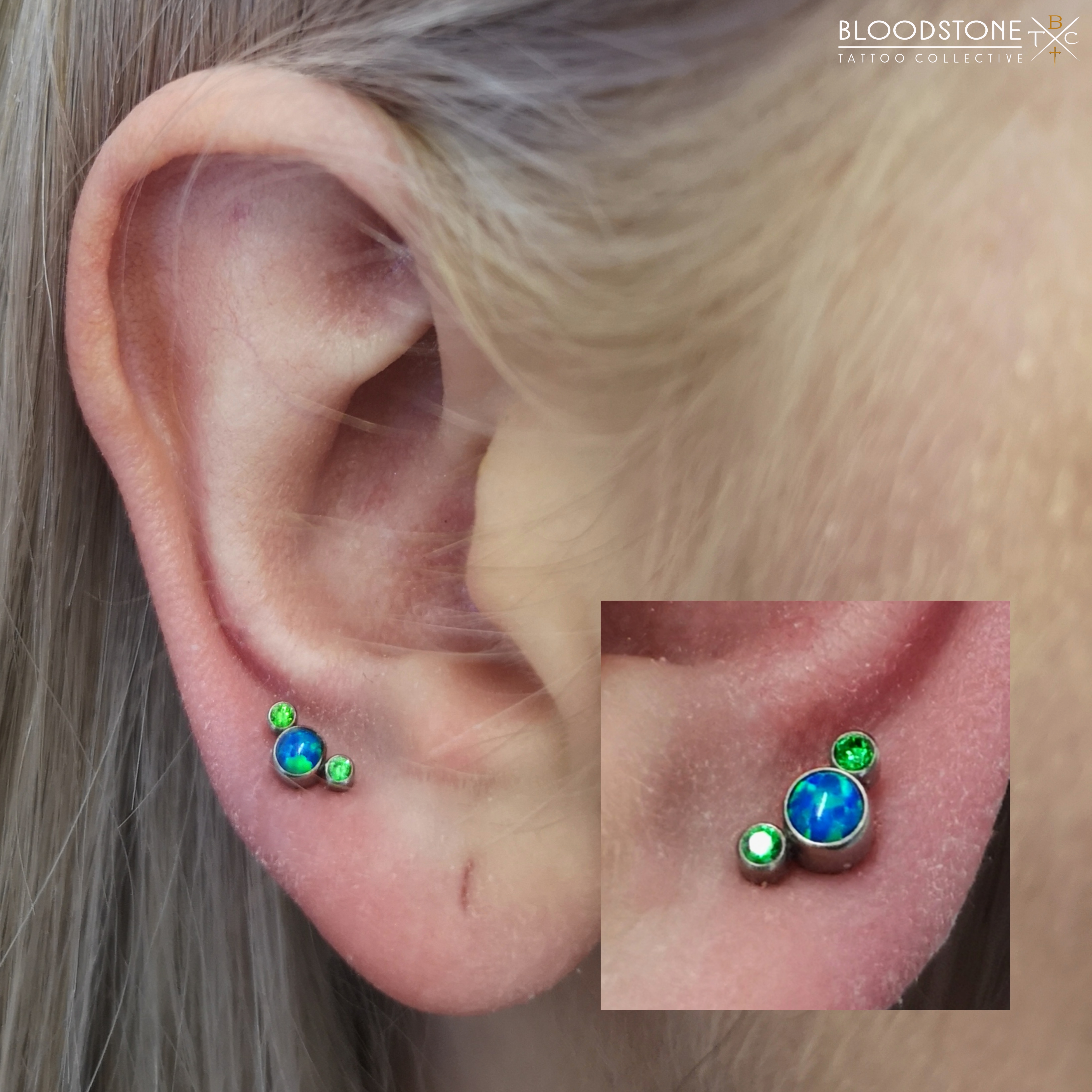Healed Lobes with The "Green Moon Coral"