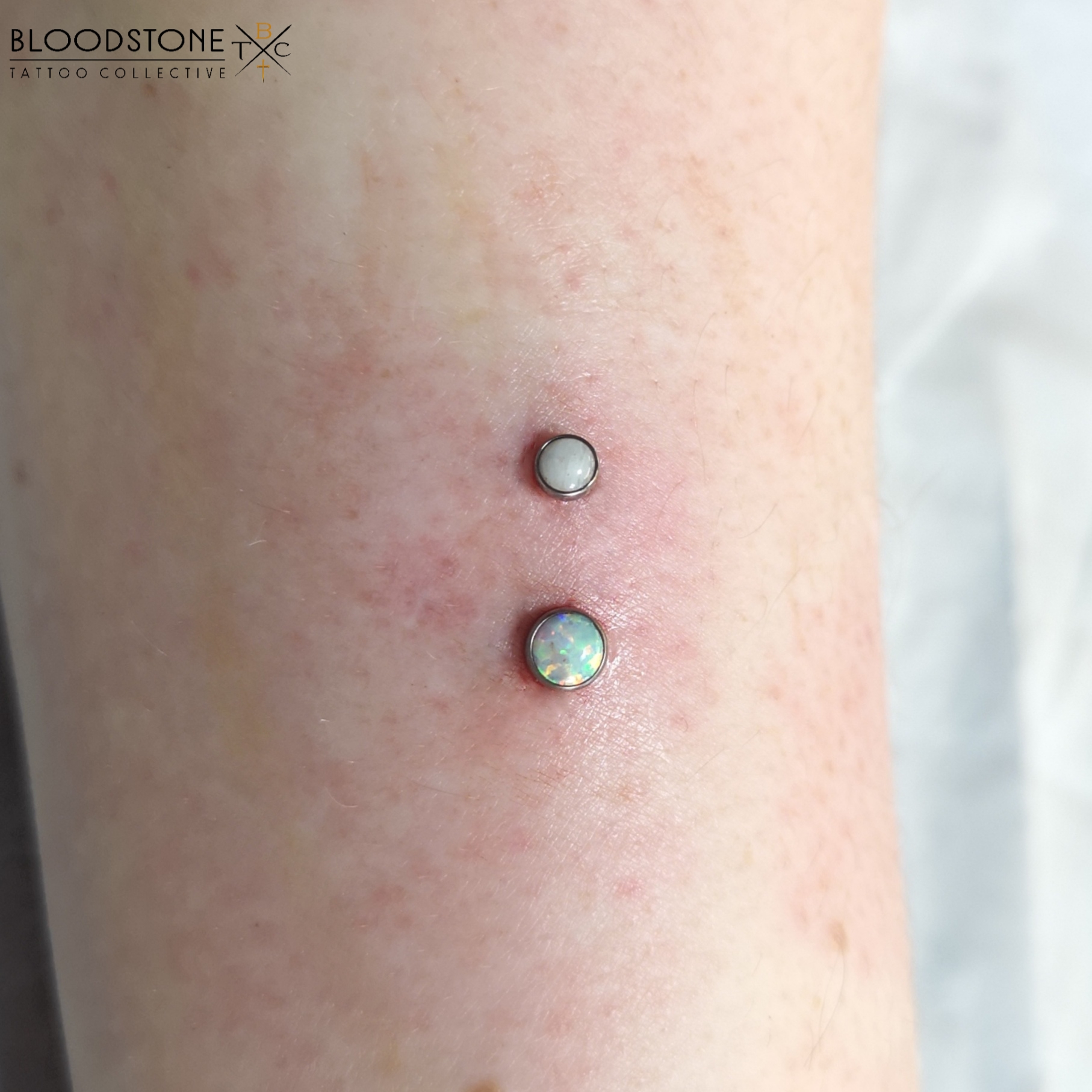 Fresh dermals