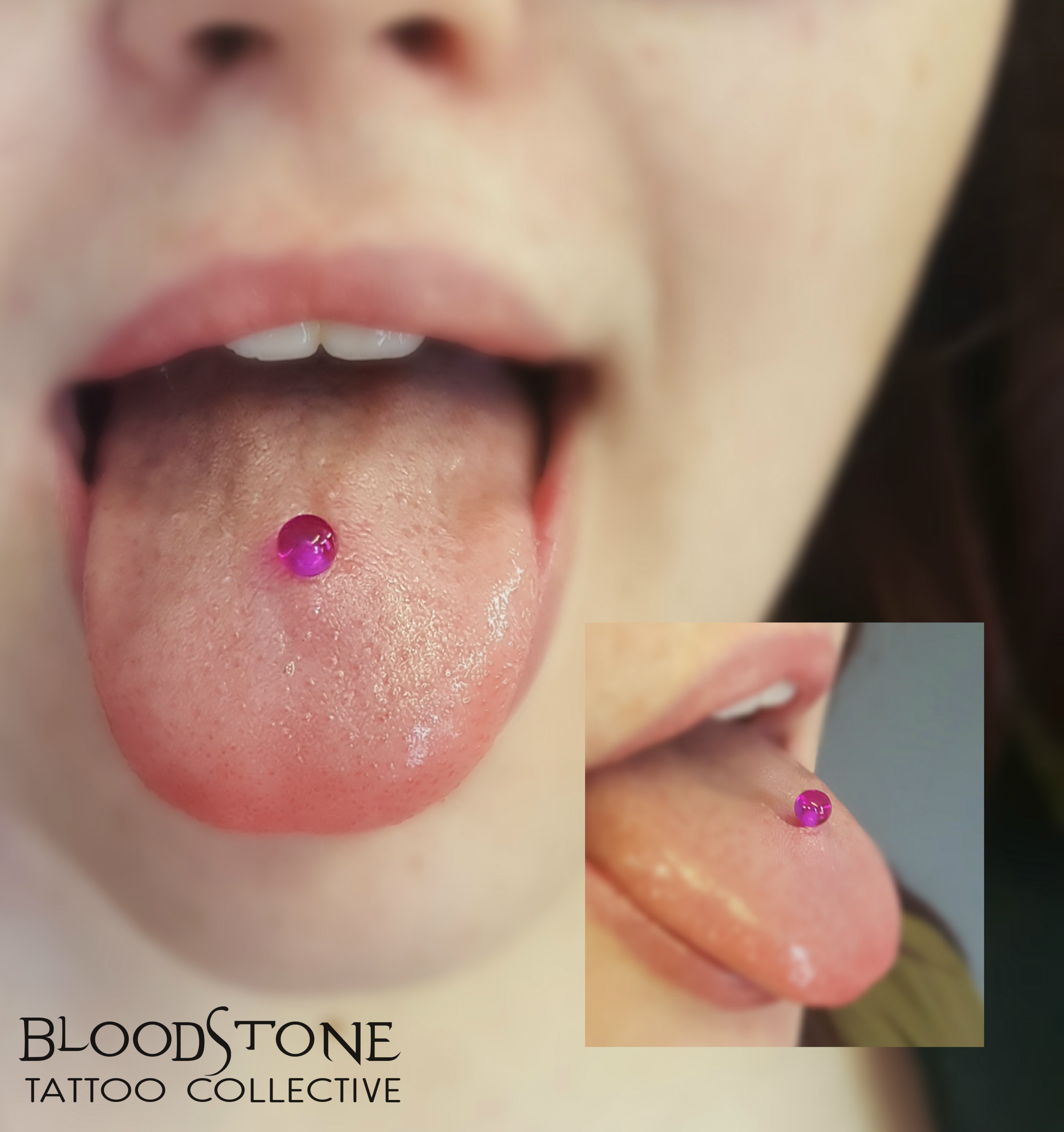 healed tongue