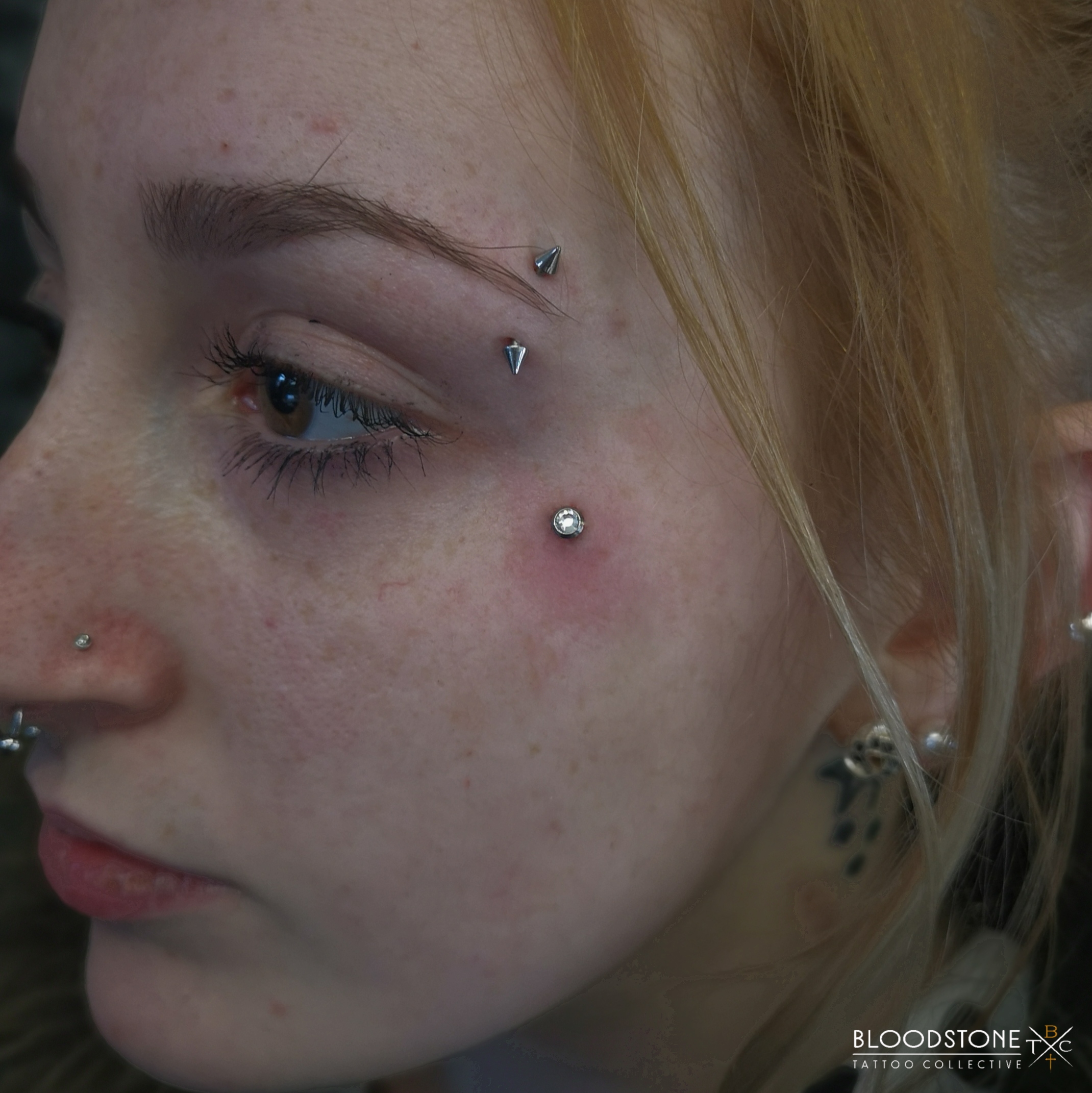 Fresh face dermal