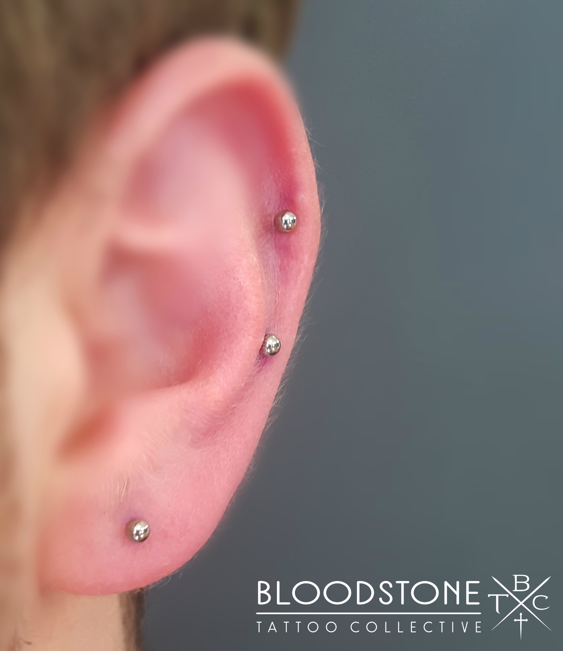 Lobe and two helix