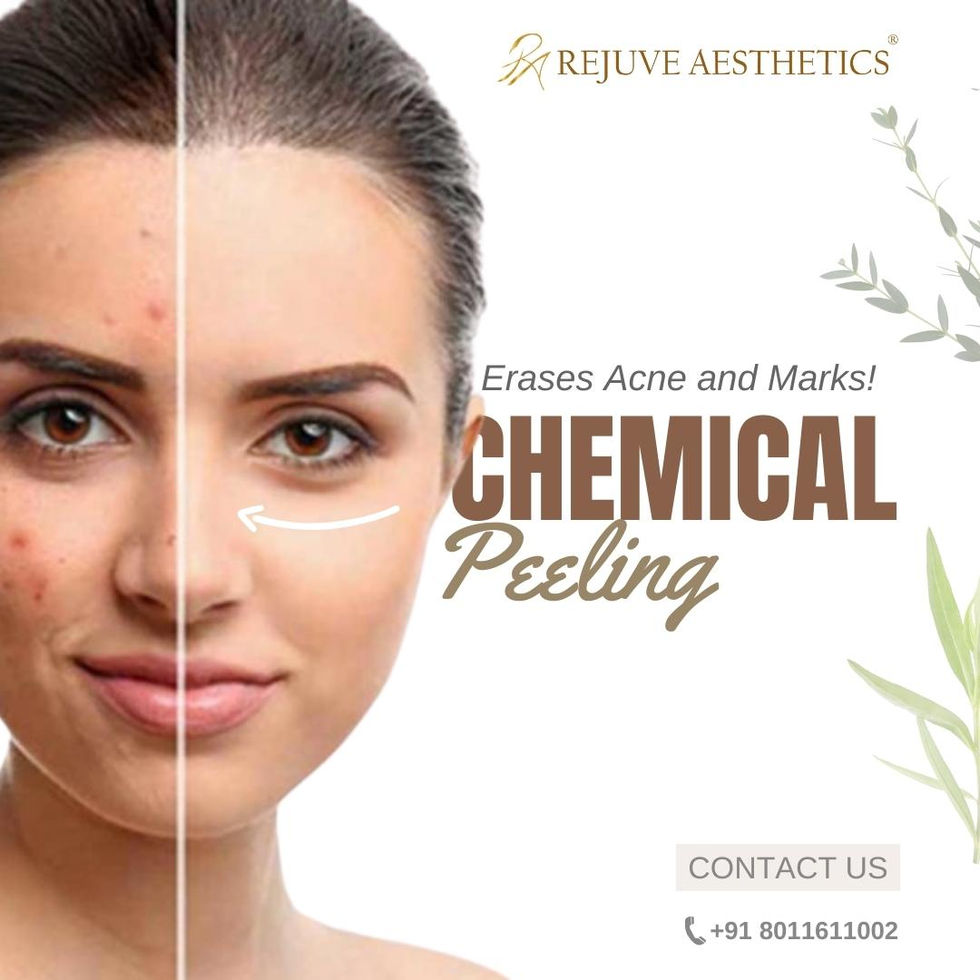 RA Design Part 2 Design Posts (3)