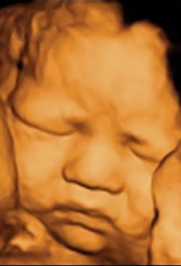 Beautiful Bump HD Ultrasound