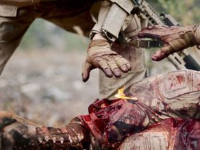 O Tratamento de Ferimentos por Arma de Fogo.