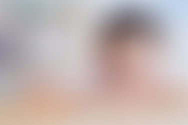 Mắt lồi bẩm sinh và nỗi lo của các bậc cha mẹ