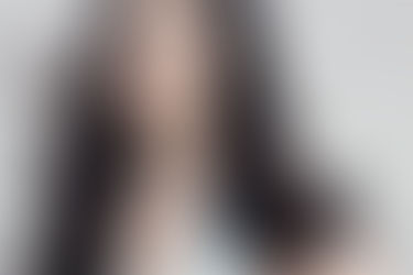 Cắt bọng mắt dưới hồi phục nhan sắc tuổi xuân