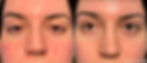 JT_Envision_Lumecca___Forma_Cheeks_3-TM