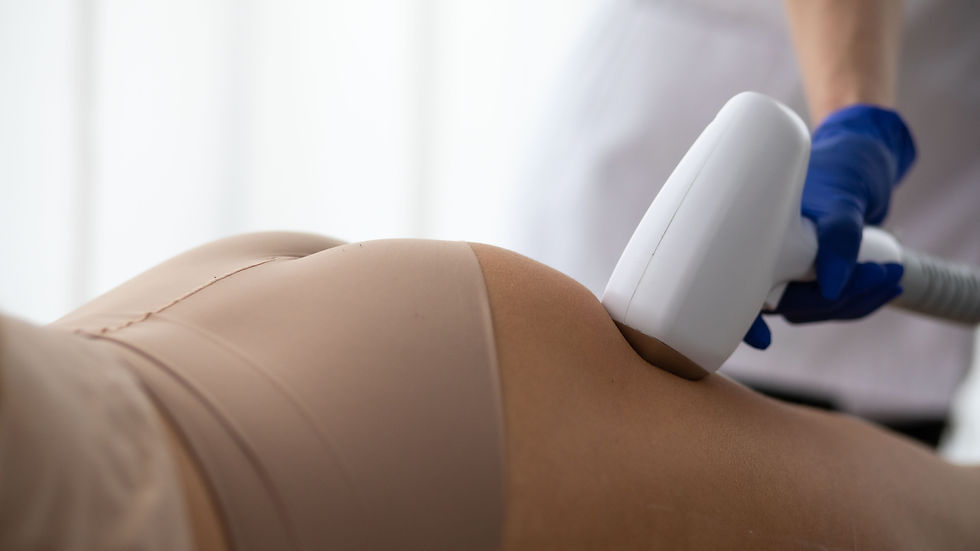 Laser Hair Removal - Buttock