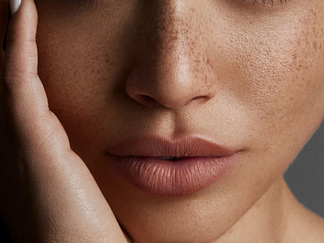 Post Microneedling Skin Glow 