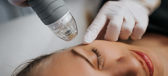 Medical Microneedling In Nottingham