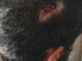 Arabs attacked Jews in Jerusalem on Tisha B'Av