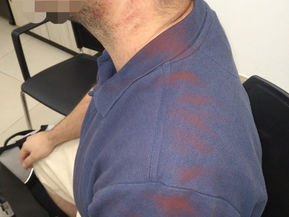 Arab youths attacked Jewish youth on Jerusalem light rail