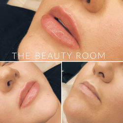 Lip Enhancement