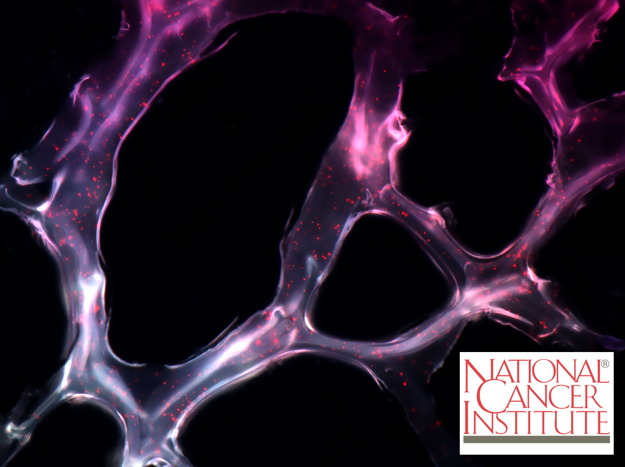NCI image award 2016