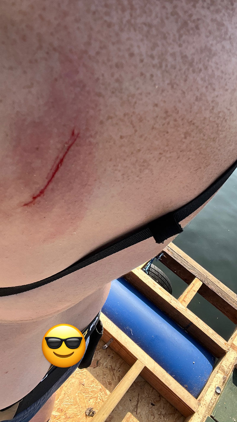 While doing the strap, a 20kg piece of plywood fell on my back.