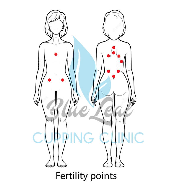 Hijama Cupping Fertility Points