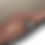 Thumbnail: Comb Riser Kit