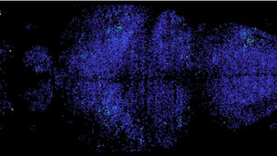 MIT's High-Speed Microscope Captures Brain Electrical Activity